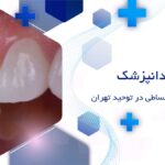 دکتر لمینت دندان اقساطی در توحید تهران