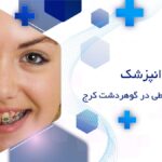 ارتودنسی اقساطی در گوهردشت کرج
