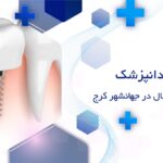 ایمپلنت دیجیتال دندان در جهانشهر کرج