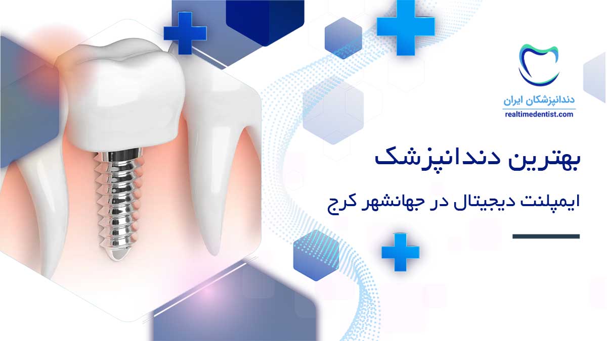 ایمپلنت دیجیتال دندان در جهانشهر کرج
