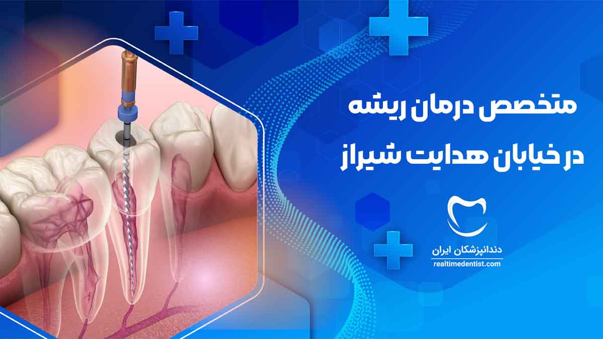 دندانپزشک متخصص درمان ریشه دندان در خیابان هدایت شیراز