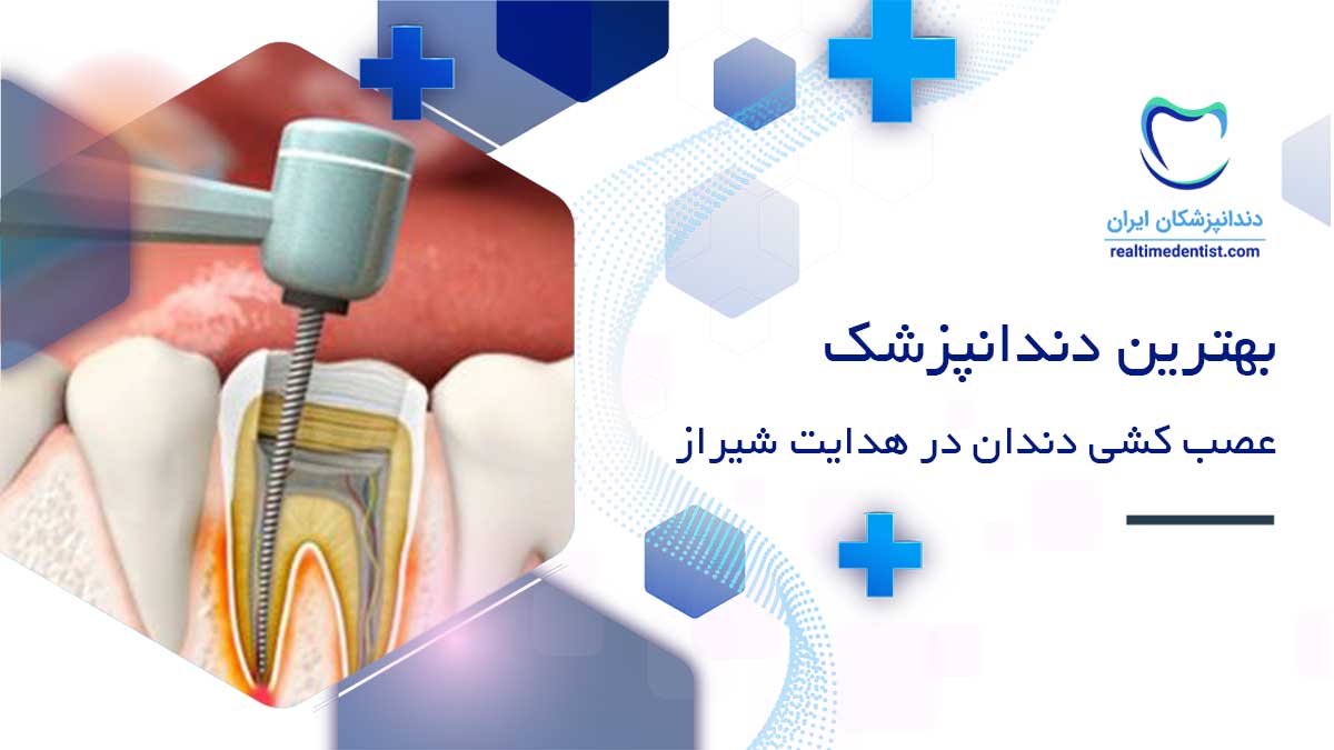 بهترین دکتر عصب کشی در خیابان هدایت شیراز