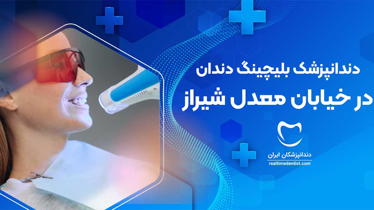 نوبت دهی دندانپزشک بلیچینگ دندان در خیابان معدل شیراز