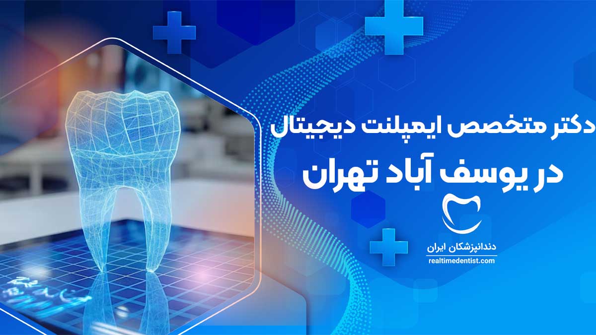 ایمپلنت دیجیتال در یوسف آباد تهران