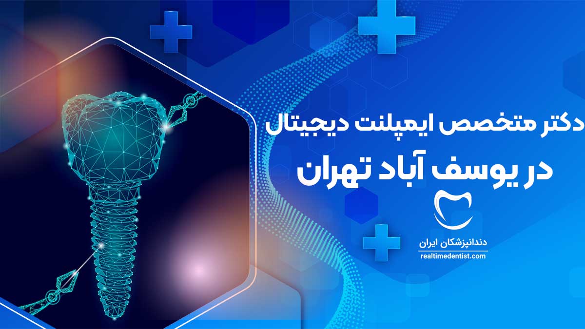 ایمپلنت دیجیتال در یوسف آباد تهران