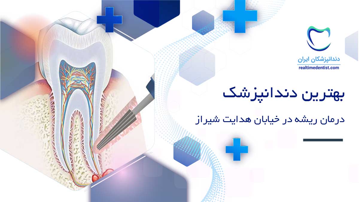 دندانپزشک متخصص درمان ریشه دندان در خیابان هدایت شیراز
