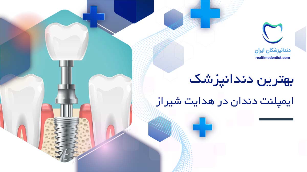 بهترین دندانپزشک ایمپلنت دندان در خیابان هدایت در شیراز