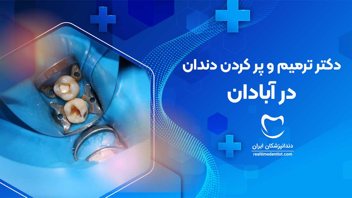 بهترین دندانپزشک ترمیم و پر کردن دندان در آبادان