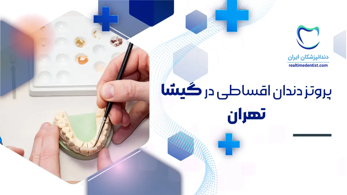 پروتز دندان اقساطی در گیشا تهران