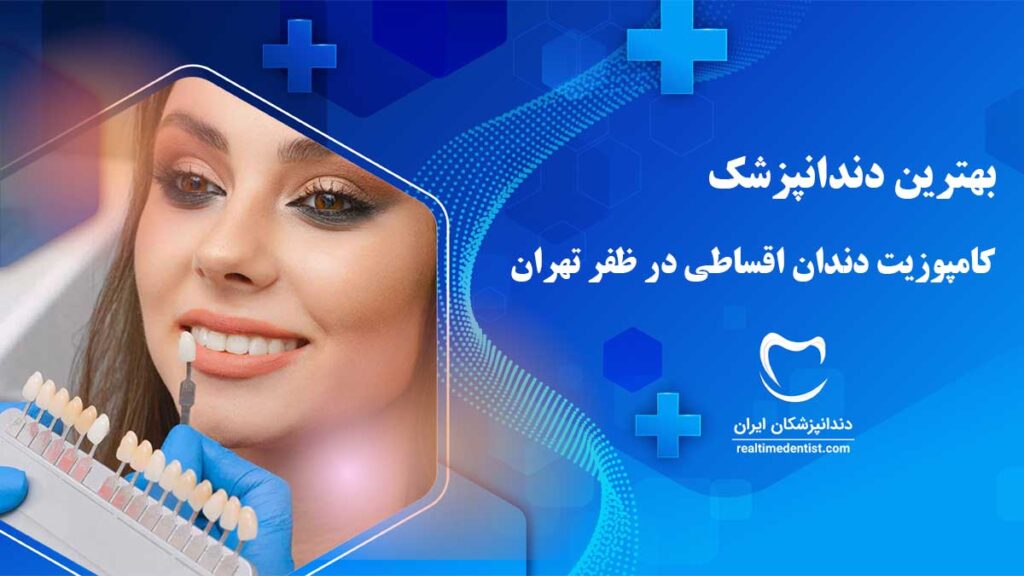 کامپوزیت دندان اقساطی در ظفر تهران