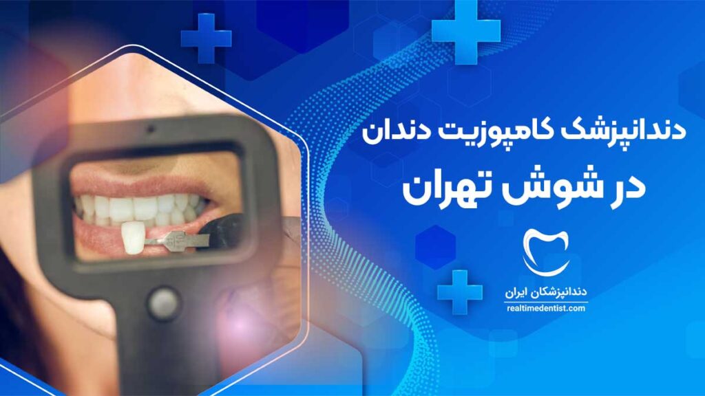 کامپوزیت دندان در شوش تهران