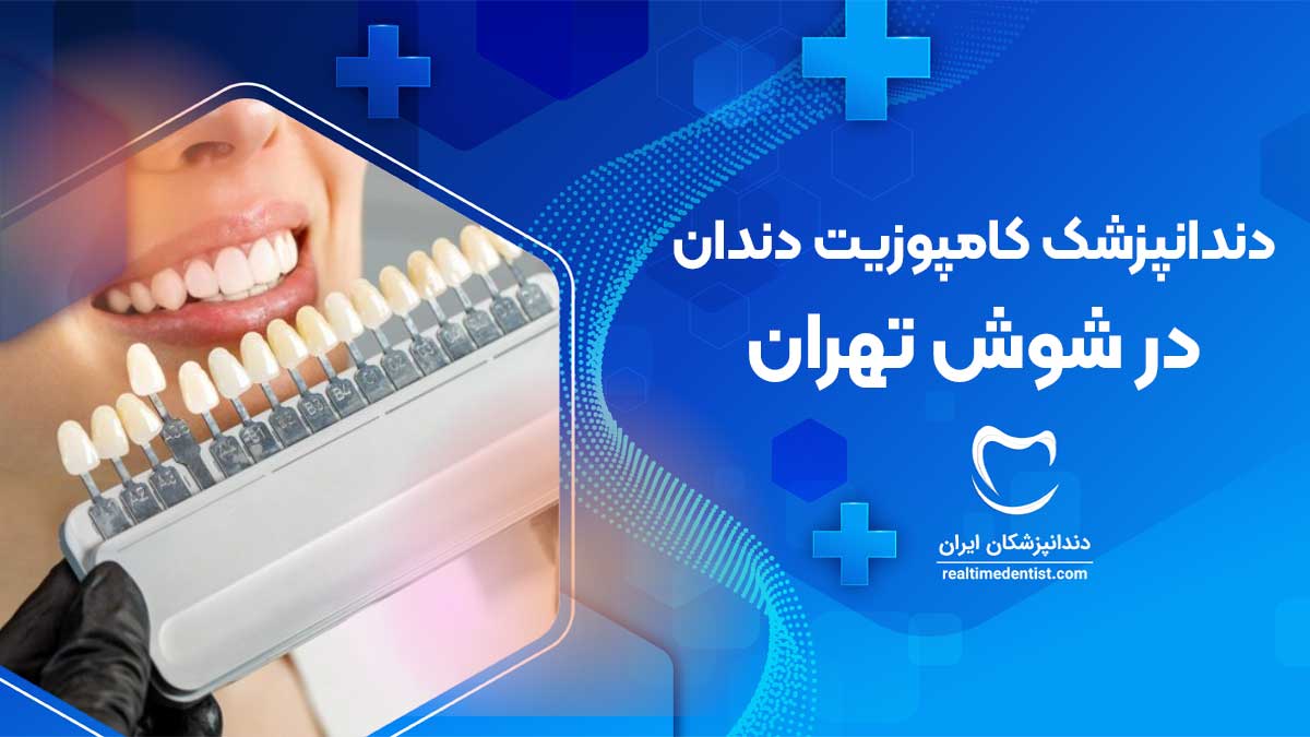 کامپوزیت دندان در شوش تهران