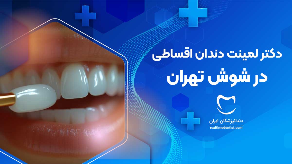 لمینت دندان اقساطی در شوش تهران