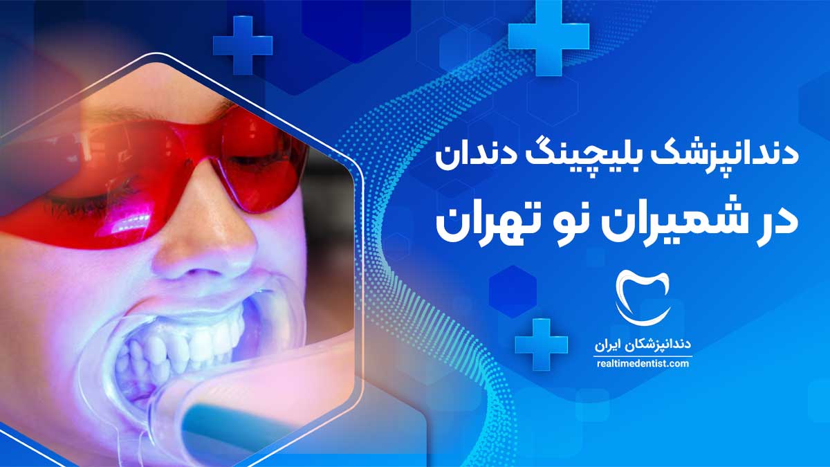 بلیچینگ دندان در شمیران نو تهران