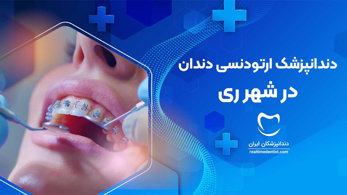 ارتودنسی دندان در شهر ری