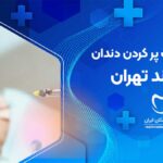 پر کردن دندان در پرند تهران