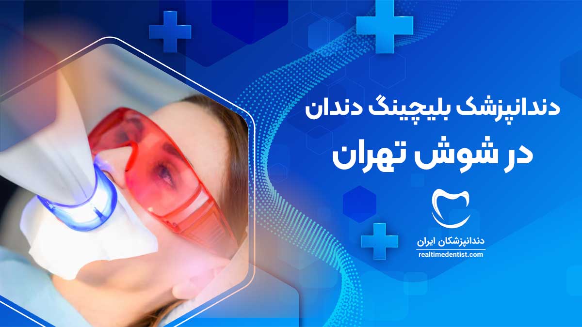 بلیچینگ دندان در شوش تهران