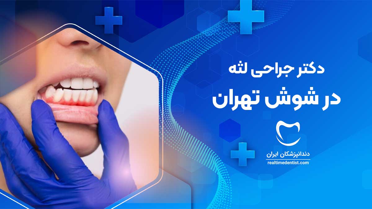 جراحی لثه در شوش تهران