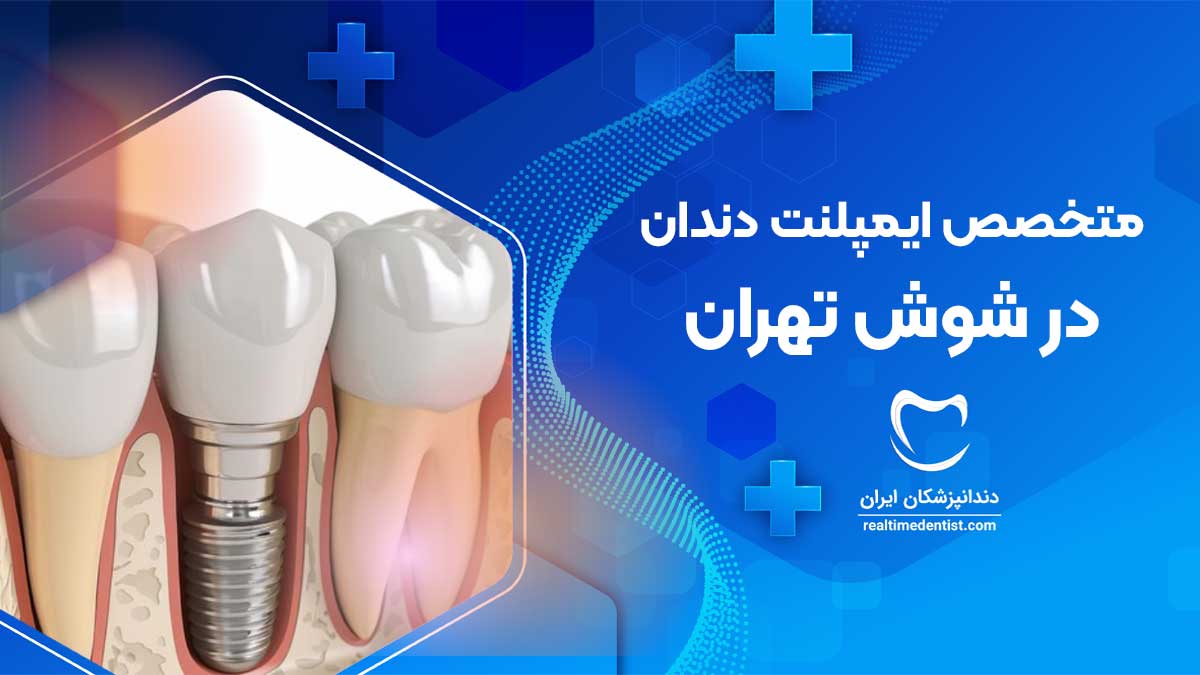 ایمپلنت دندان در شوش تهران