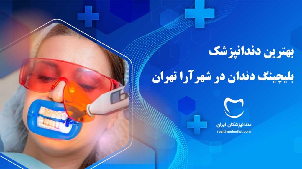 دندانپزشک بلیچینگ دندان در شهرآرا تهران