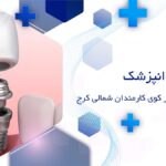 ایمپلنت دندان در کوی کارمندان شمالی کرج