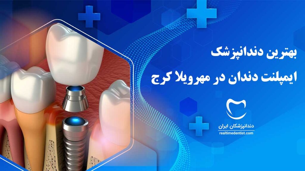 ایمپلنت دندان در مهرویلا کرج