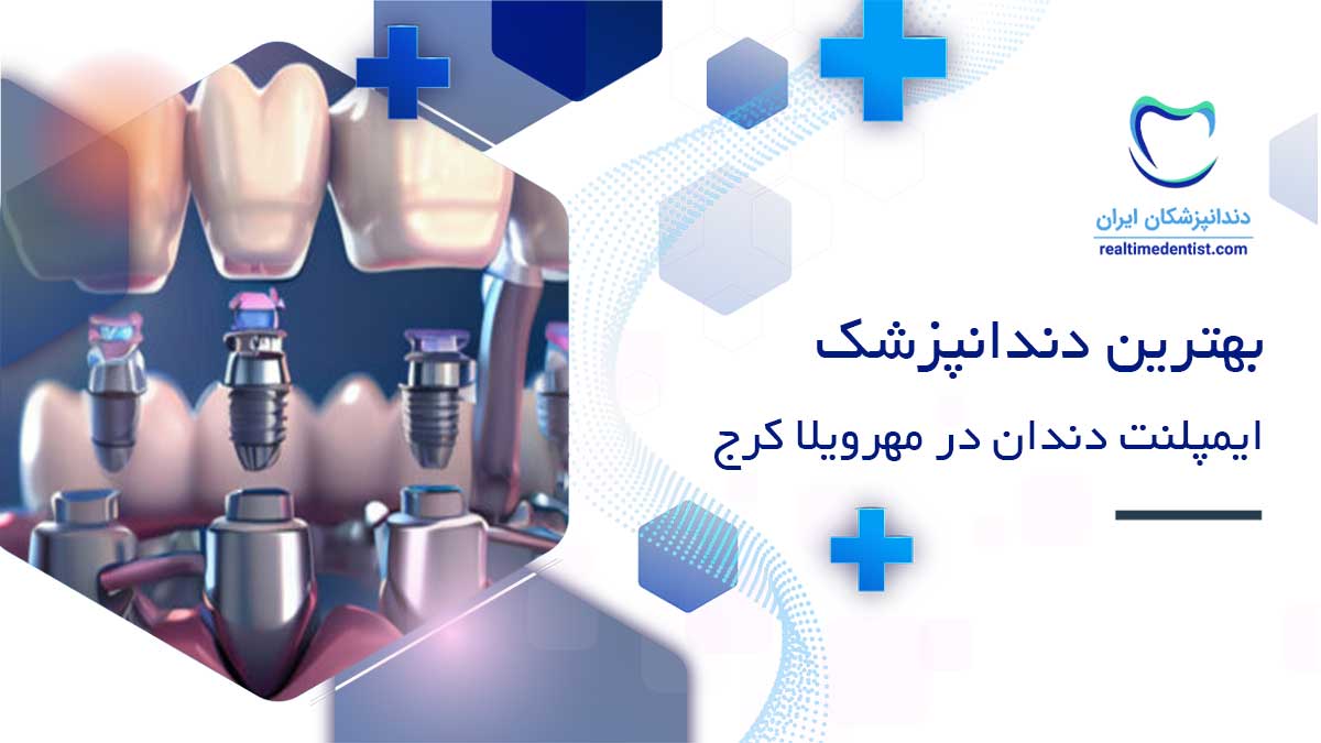 ایمپلنت دندان در مهرویلا کرج