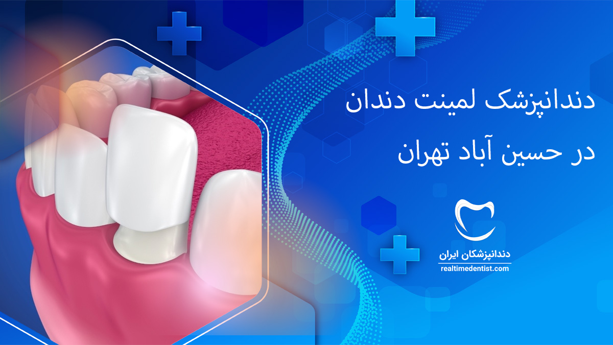 لمینت دندان در حسین آباد تهران