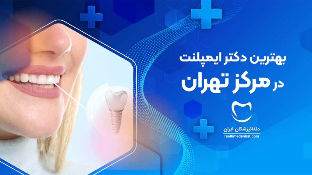 آدرس و تلفن مطب بهترین دکتر ایمپلنت در مرکز تهران به همراه نمونه کار کاشت دندان