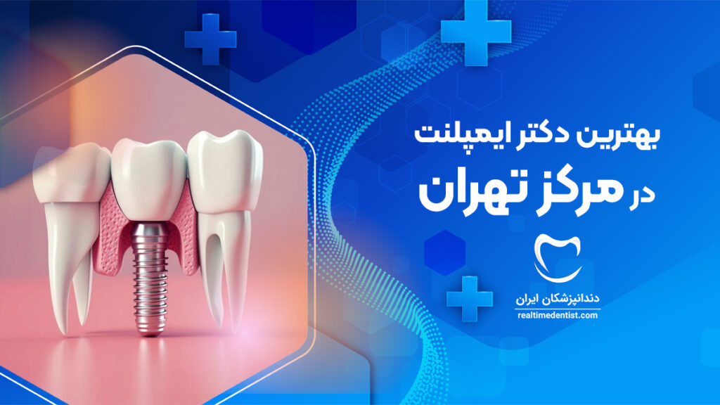 Hnsvآدرس و تلفن مطب بهترین دکتر ایمپلنت در مرکز تهران به همراه نمونه کار کاشت دندان