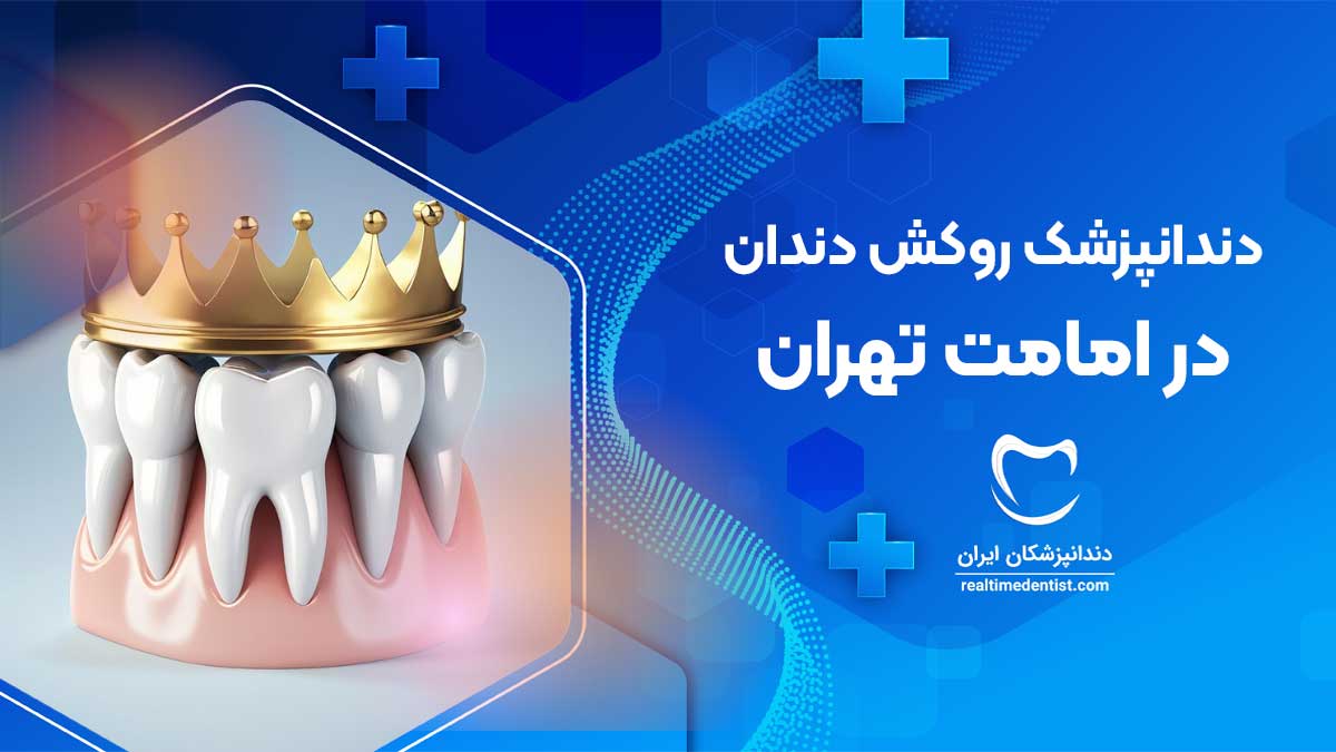 روکش دندان در امامت تهران