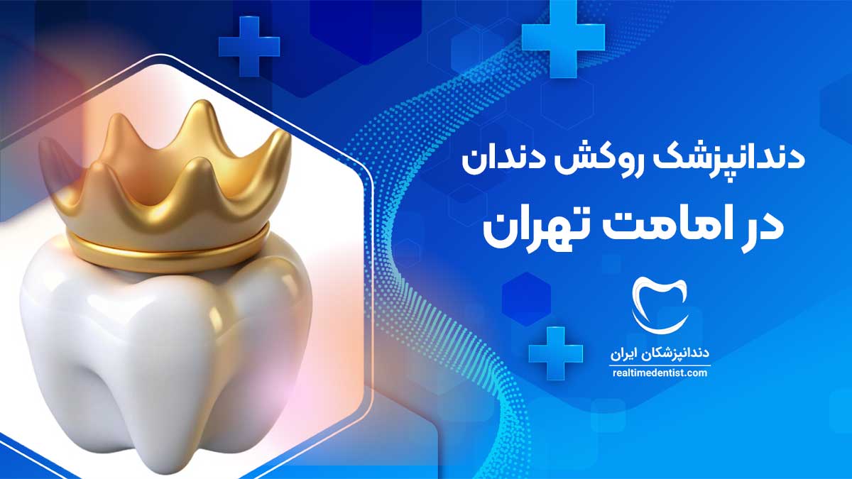 روکش دندان در امامت تهران