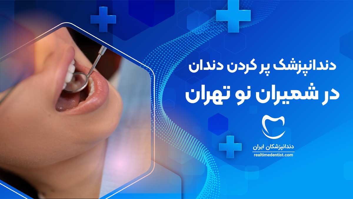 پر کردن دندان در شمیران نو تهران