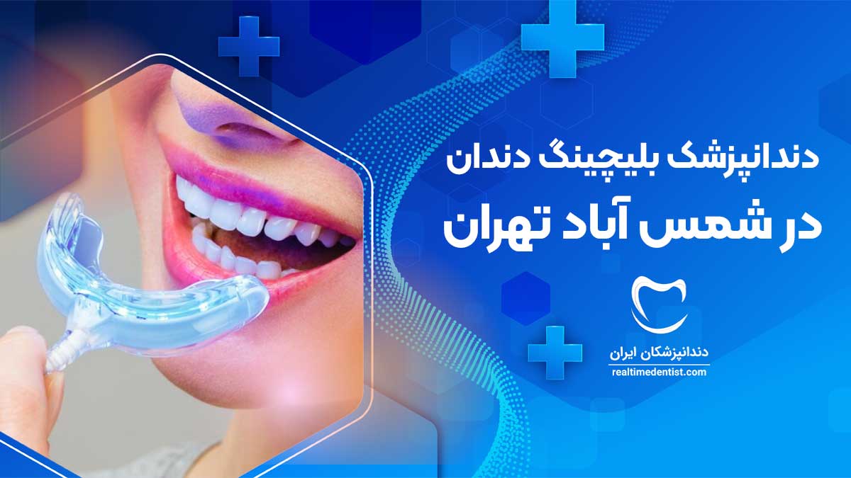 بلیچینگ دندان در شمس آباد تهران