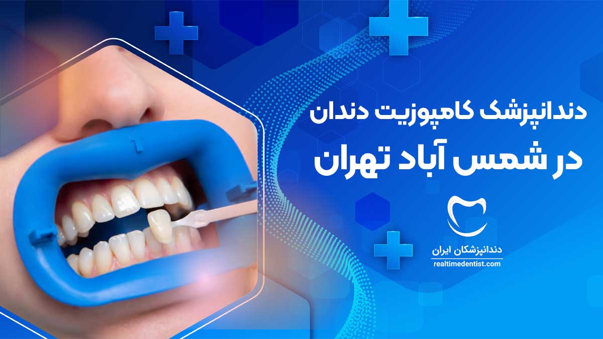کامپوزیت دندان در شمس آباد تهران