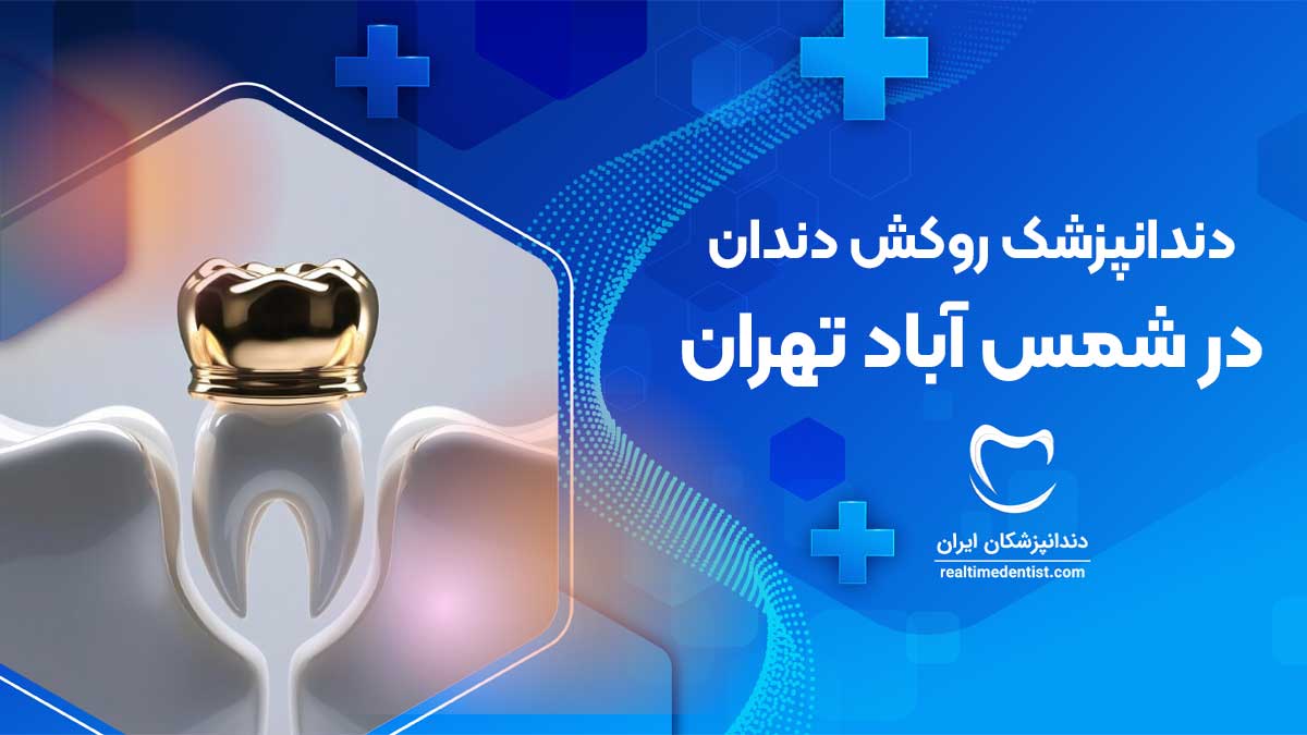 روکش دندان در شمس آباد تهران