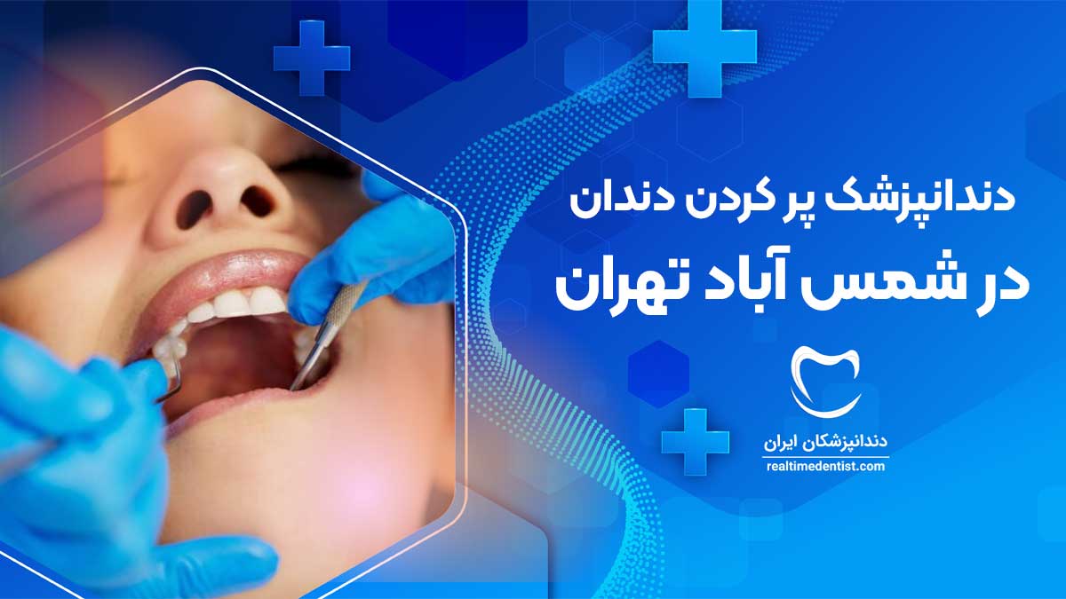 پر کردن دندان در شمس آباد تهران