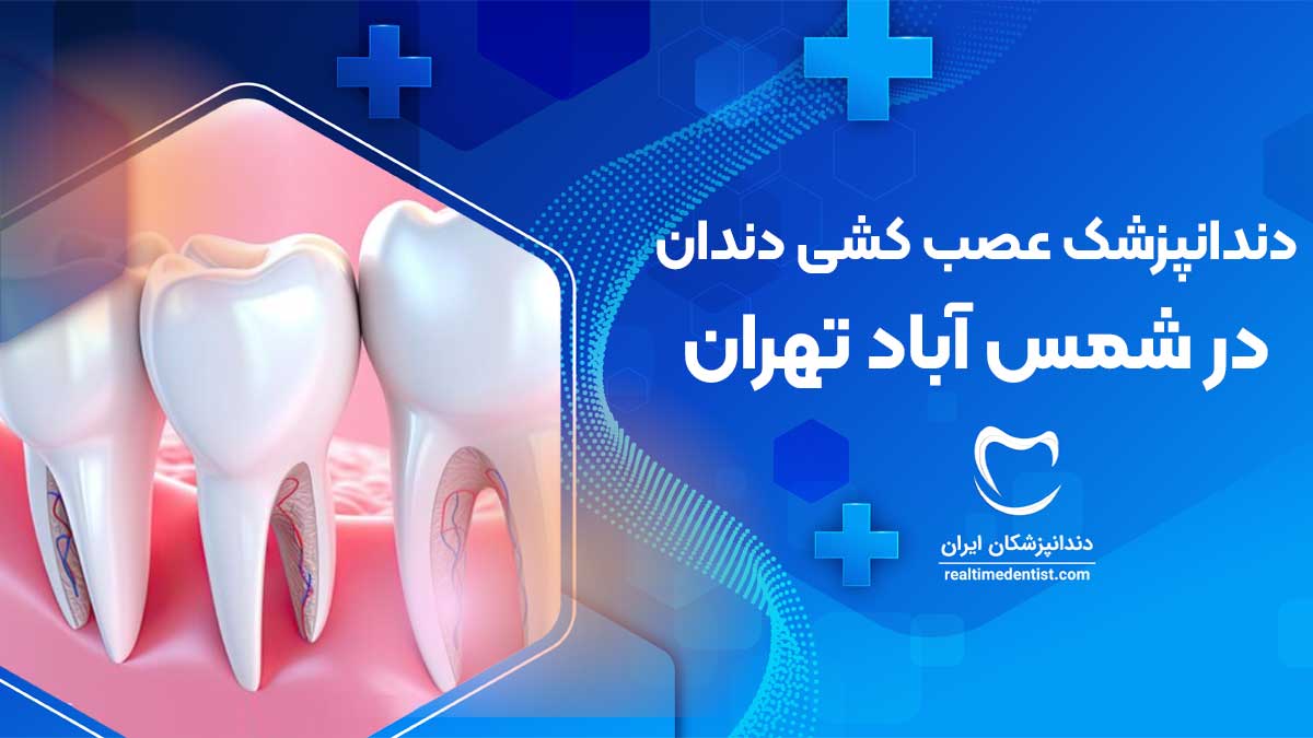 عصب کشی دندان در شمس آباد تهران
