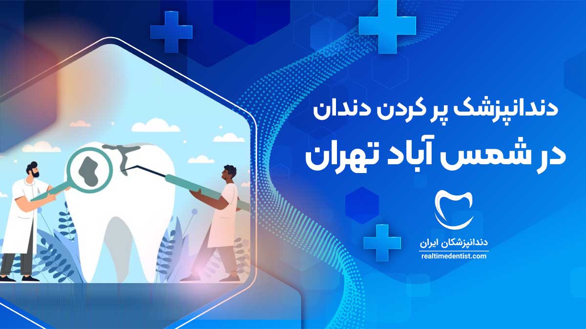 پر کردن دندان در شمس آباد تهران