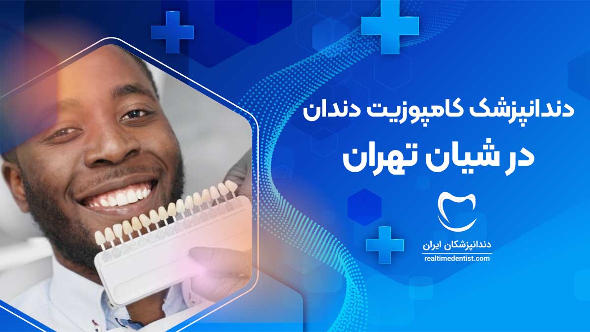 کامپوزیت دندان در شیان تهران