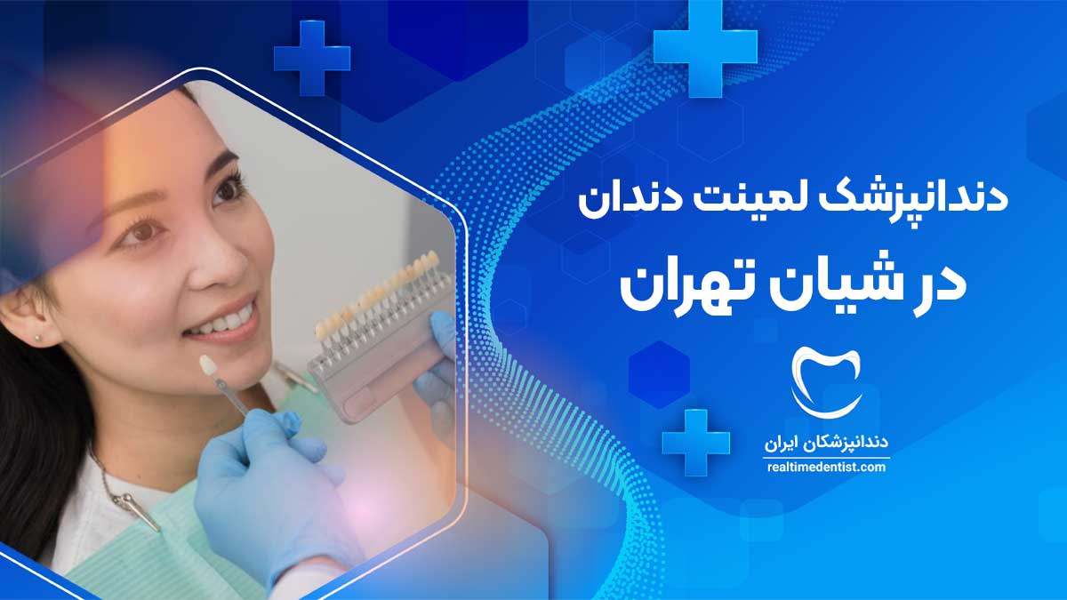 لمینت دندان در شیان تهران