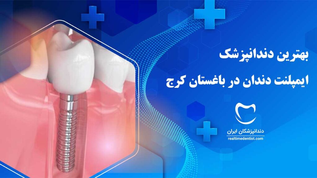 ایمپلنت دندان در باغستان کرج