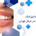 بهترین متخصص جراحی لثه در مرکز تهران