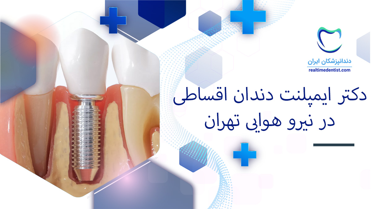 بهترین دکتر ایمپلنت دندان اقساطی در نیرو هوایی تهران