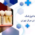 بهترین متخصص ایمپلنت در مرکز تهران