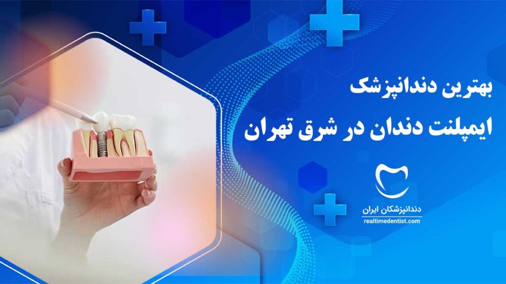 بهترین متخصص ایمپلنت در شرق تهران