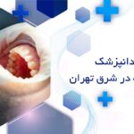 بهترین متخصص جراحی لثه در شرق تهران