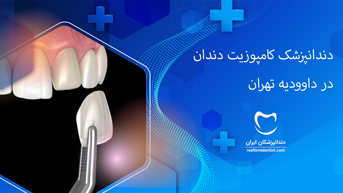 کامپوزیت دندان در داوودیه تهران