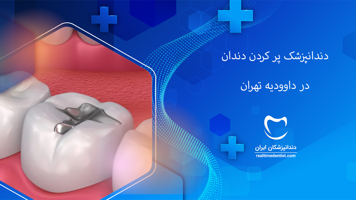 پر کردن دندان در داوودیه تهران