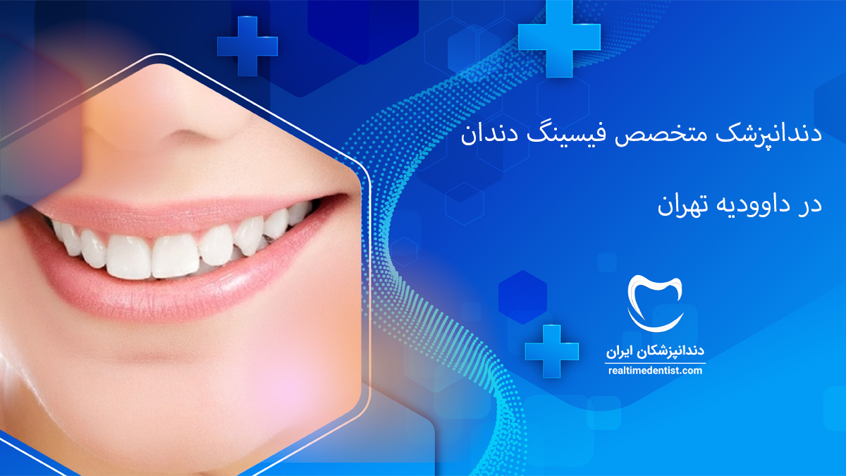 فیسینگ دندان در داوودیه تهران